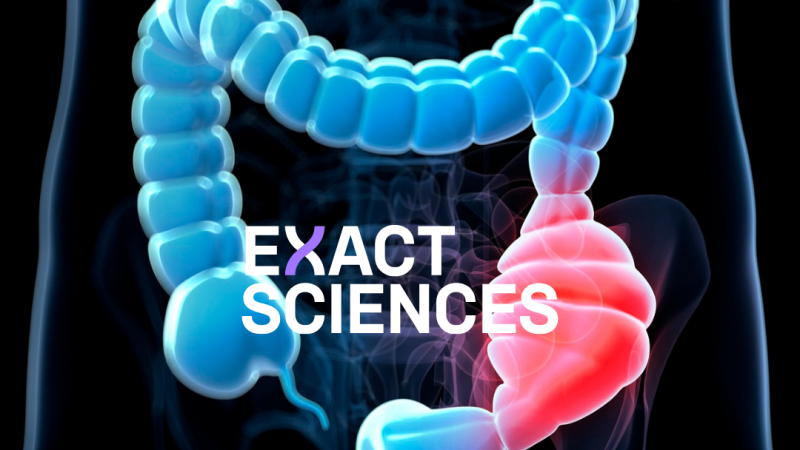 Exact Sciences Releases Data Showing Effectiveness Of Cancer Test 20250122 215010 0000